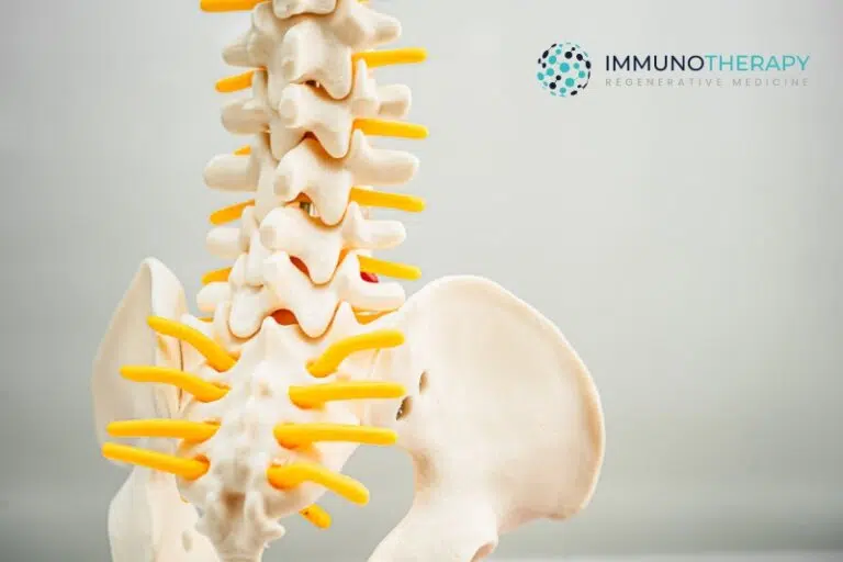 Stem cell therapy Regenerative Medicine for Degenerative Disc Disease