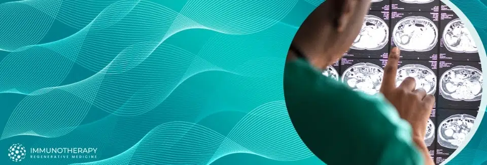 Stem Cell Therapy for Neurological Disorders