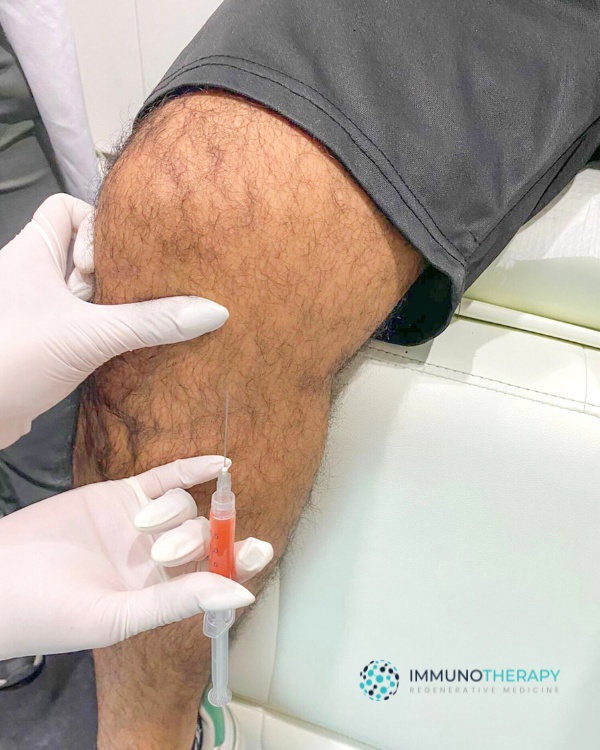 Stem Cell Injections Treatment for Knees Pain in puerto vallarta Mexico