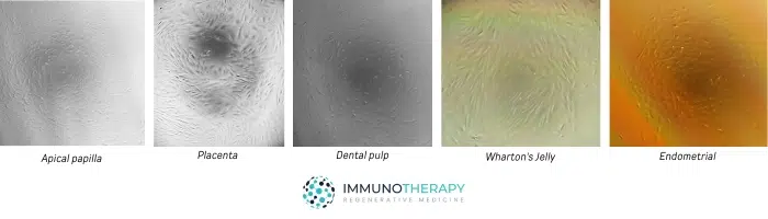 Mesenchymal Stem Cells (MSCs)Apical papilla, Dental pulp, Endometrial