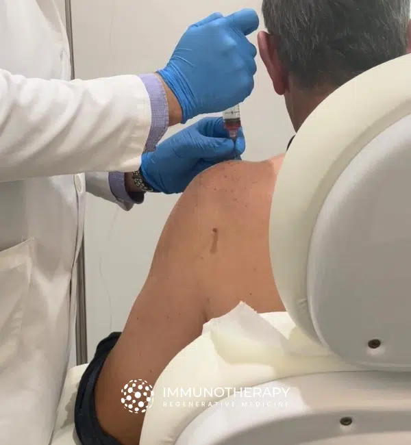 Stem Cell Treatment for Joint Pain in Mexico