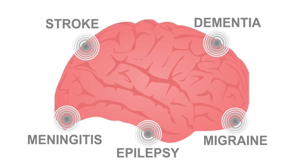 Treatment for neurological disorders