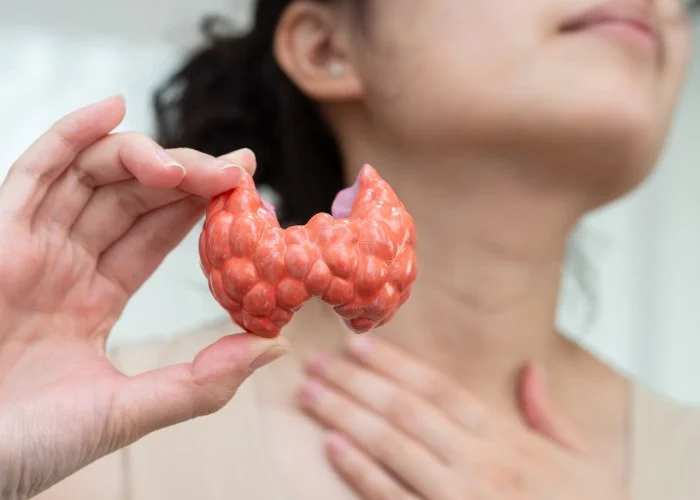 Tratamiento alternativo para el cáncer de linfoma en México