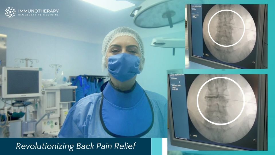Terapia con células madre para el dolor de espalda en México
