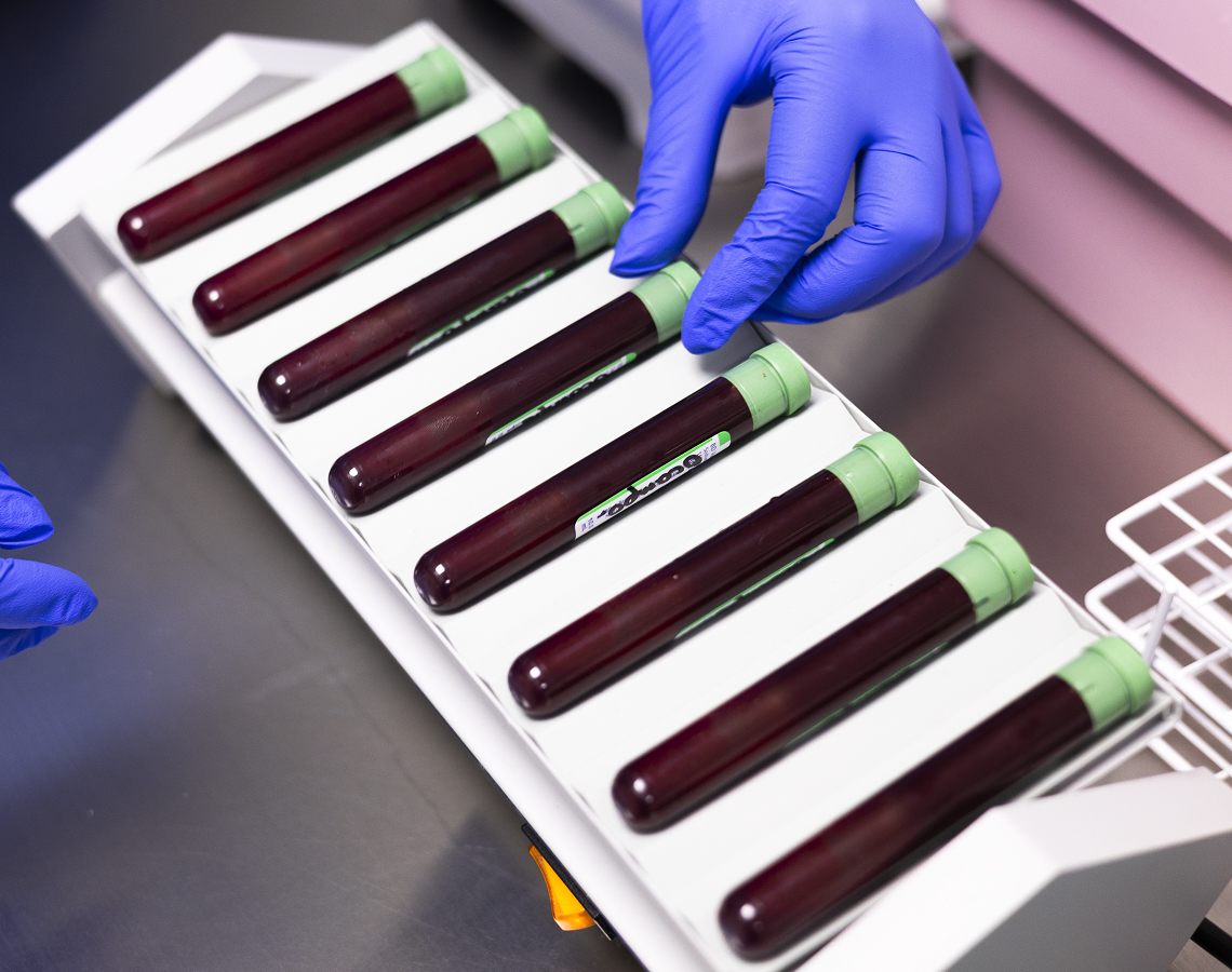 Stem Cell Treatment For Multiple Sclerosis In Mexico | MS Care
